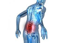 Ankilozan Spondilit (Omurga Kemiği İltihabı) Nedir? Belirtileri Nelerdir? -  CENTRAL HOSPITAL