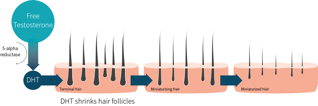 creatine-hairloss.png