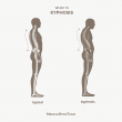 1387321-what-is-kyphosis-1080x10.png