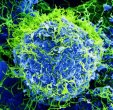 Ebola_Virus_-_Electron_Micrograph.tiff.jpg