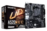 Am4 veya LGA1700 anakart arıyorum